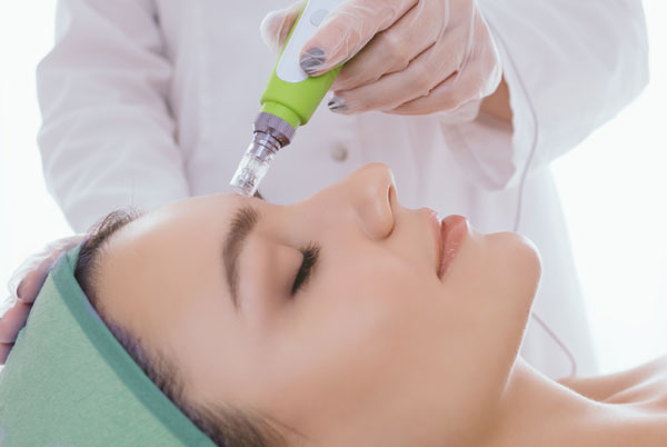 RoshaClinicMicroneedling